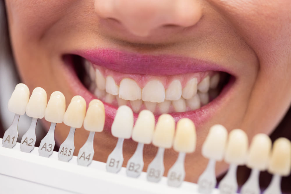 dentista examina paciente femenino tonos dientes