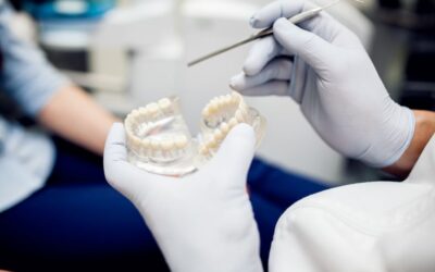 Conoce 25 ventajas de los implantes dentales