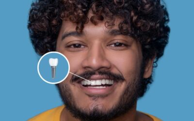 Implantes dentales en Madrid