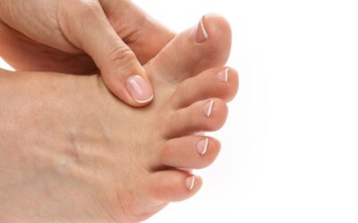 Juanetes (Hallux Valgus): causas, síntomas y tratamientos