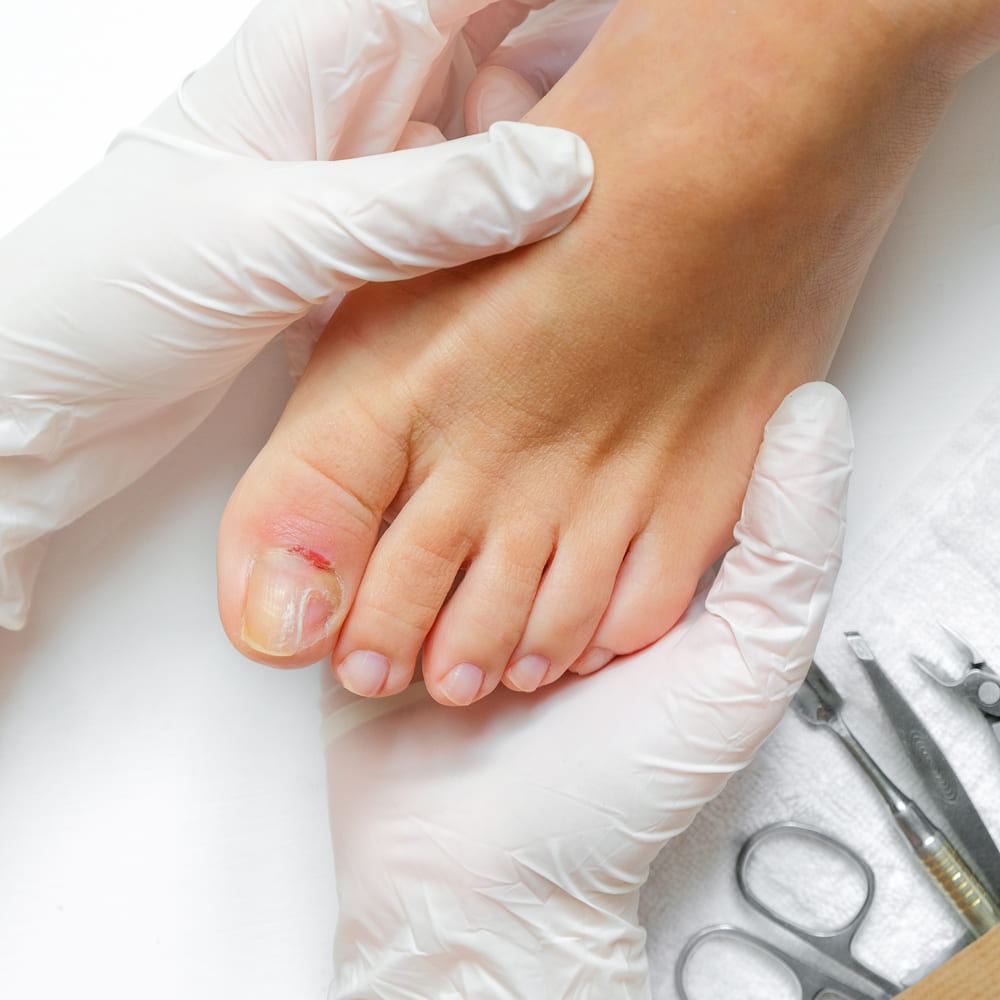 pedicura podologo paciente en pedicura medica